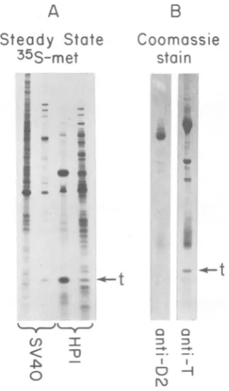 FIG. 3. HP). Quantitation of small t antigen produced (A) Samples containing 106 cpm of extract