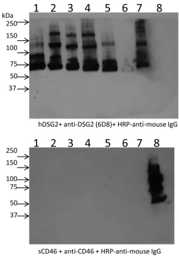 FIG 4 Analysis of Ad3 ﬁber knob binding to soluble CD46. Ad3 ﬁber knobscontaining different numbers of shaft motifs and either the wild-type Ad3 ﬁberknob (lane 1, Ad3-S6/Kn; lane 2, Ad3-S5/Kn; lane 3, Ad3-S4/Kn; lane 4, Ad3-S3/Kn; lane 5, Ad3-S2/Kn; lane 6