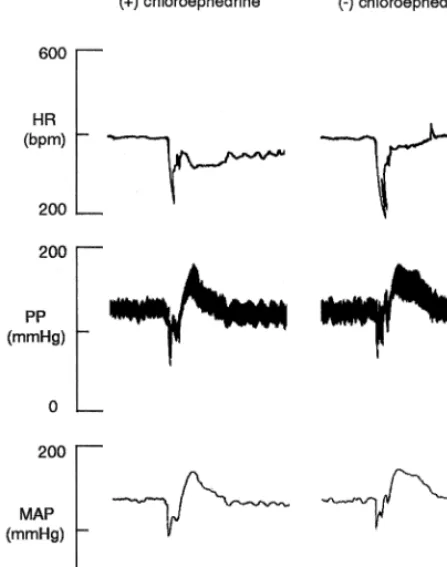 Fig. 3. Polygraph records showing typical HR, pulse pressure (PP)and MAP responses elicited by the i.v