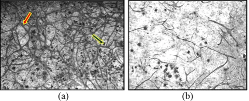 Figure 1: Two representative images. (a) An image of a 0 Gy (control) cultured murinae heart cell