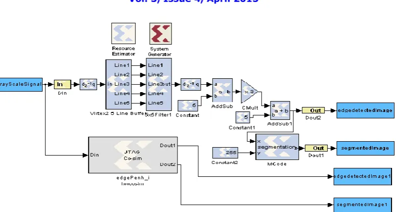 Fig. 3 Architecture of Exudates detection using Sobel Edge Detection  