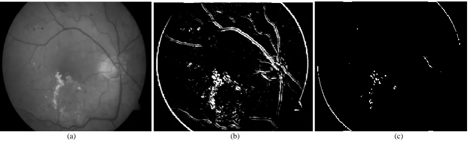 Fig.5: Sobel Operator (a) Input Image  (b) Edge Detected Image  (c) Segmented Image 