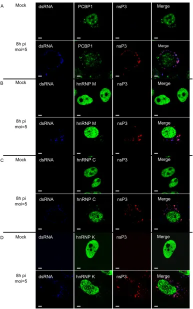 FIG 5 PCBP1, hnRNP M, hnRNP C, and hnRNP K colocalize with SFV nsP3 and dsRNA. SFV-infected and mock-infected HeLa cells were ﬁxed at 8 h p.i.,permeabilized, and probed with antibodies for dsRNA (blue) and SFV replicase (anti-nsP3; red)