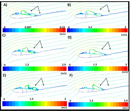 Figure 14 Path-line coloured by mean velocity magnitude at velocity equal to 1.8 m/s (acceleration flow) A) NACA0015 without slots B)  