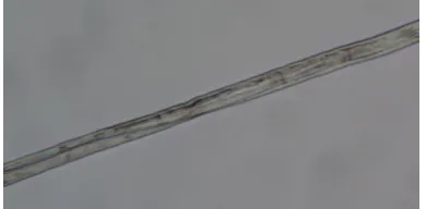 Figure 4. Optical Micrograph of Unmercerized Cotton Fibers 
