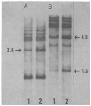 FIG. by theand autoradiography.1; slot 2, tumor 2 fromanimalrestriction ipg)andwas 2; digested slot 4, withsigead analyzed ismgle,n ORrestrctio maimmary patternspattes tumor of~~ments.__from (B,Slot (9Southerneitheranimal 1,_w.i animal EcoRI*-lrB.....