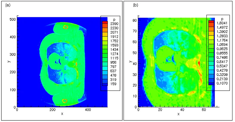 Figure 2.1: An example CT image and the corresponding density image. 