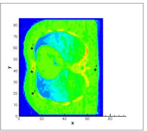 Figure 4.1 : CT image with the four sample points 