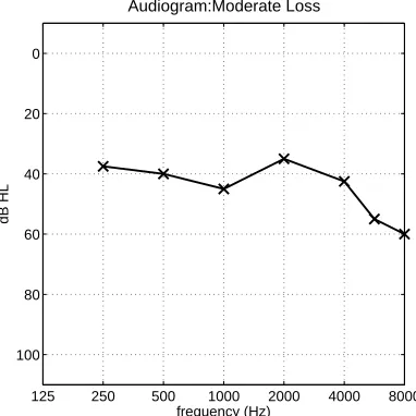 Figure 2.5: Sample audiogram showing hearing thresholds for a subject with a moderate sen-