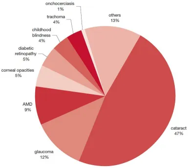 Figure 1.1 – Global causes of blindness due to eye disease; glaucoma is the second 