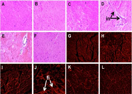 Table S4). The left ventricle showed increased infiltration of inflammatory cells (Figure 2D) and 