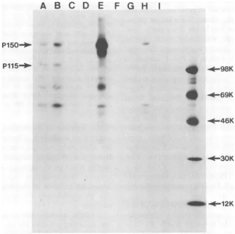 FIG. 9.preparedgoatsuperinfectedwithandin medium Deternination of the extent ofphosphorylation ofMcDonough FeSV P170 by imunoprecipitation SDS-PAGE analysis