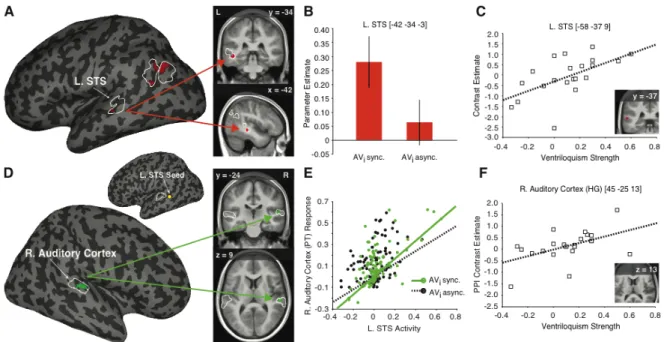 Figure  11.   The  neural  correlates  of  the  imagery-induced  ventriloquist  effect