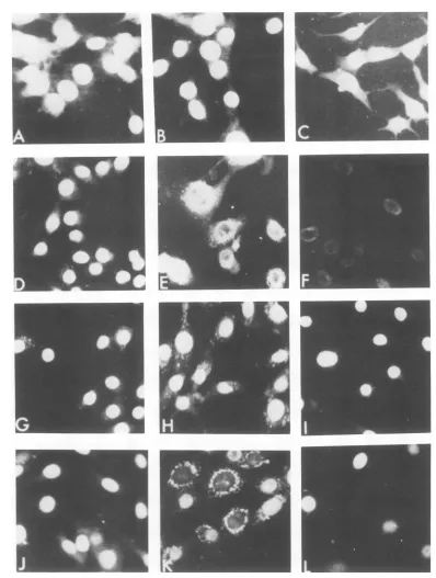 FIG. 1.grownmKSA207-S6serum,serum,stainingserum.0.5% Micrographs of mKS(wt), mKSA207 Cl 6, mKSA207-S6, and S6/Rl/R'5 after immunofluorescent for T antigens (X250)