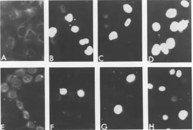 FIG. 2.serum,immunofluorescent(E) Micrographs of human retinoblastoma cells transformned by SV40(wt) and SV40 tsA207 after staining for T antigens (x250)