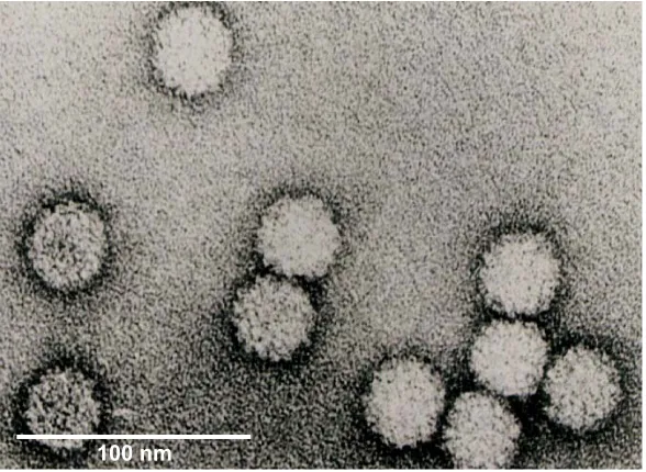 Fig. 2. The electron microscopic image of RCNMV virions. Note the spherical outline and thegranular surface of the virions, a characteristic ofTombusviridaevirus CP with protruding domains.