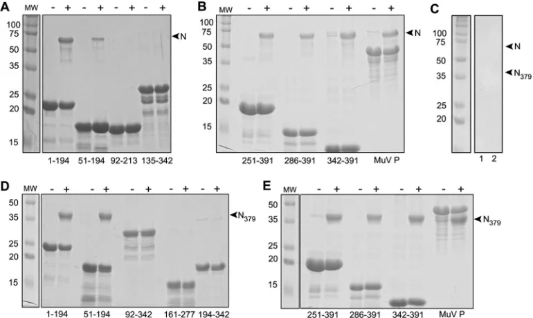 FIG 6 NLP pulldown assays. In order to determine which P fragments could interact with NLP, pulldown assays were performed