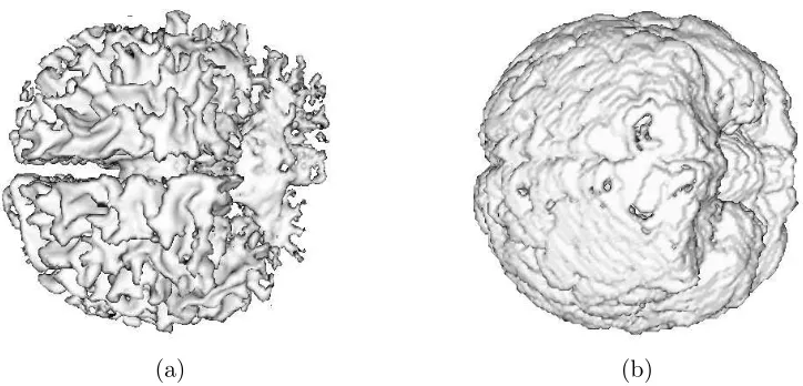 Figure 3.15: Average OM for WM and GM segmentations on 20 normal real brain dataof T1-weighted modality