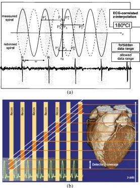 Figure 2.14. Principles of single-slice (a) and multi-slice (b) ECG-gated spiral scan (Kachelriess and 