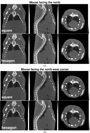 Figure 3.6. Reconstructions of the MOBY phantom from the square and the hexagonal geometries when 