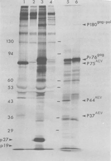 FIG. 1.phy.polyacrylamideprecipitationsproducerAEV(RPV)discussedweighttidesAEV-NPmessenger-dependent(x10-3)RNAucts.betweenscribedvirionsLanecontrolnormalcellsmediumbroblasts,immunoprecipitatedwithin vitro