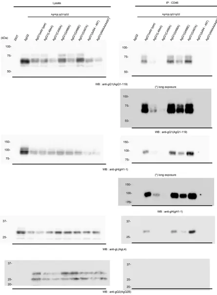 FIG 6 Interaction of AgH/AgL/AgQ1 (wild type or each mutant)/AgQ2 with CD46. 293T cells were cotransfected with AgH, AgL, AgQ2, and wild-type ormutant AgQ1, and 48 h later, the cell lysates were prepared and used for a CD46 binding assay
