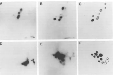 FIG. 10.and Tryptic peptide analysis of the gp7O (A-D) and p12 (E-H) of RFV-B-23 (A, E), CFV-FES-7 (B, F) clonal isolates of the MuLV ofRFV (C, G) and CFV (D, H).
