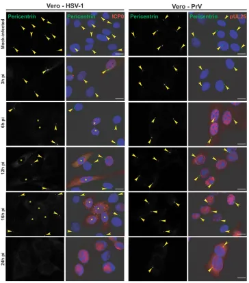 FIG 3 Differential loss of centrosomal localization of pericentrin in Vero cells infected with HSV-1 or PrV