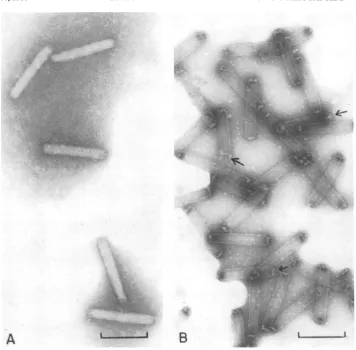 FIG. 4.g/cm3forfromincubatinguranyl Electron micrographs ofP. interpunctella GVnucleocapsids and capsids