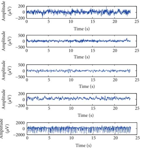 Figure 3: Exemplary EEG signals from each of the five sets. Fromtop to bottom: class Z, class O, class N, class F, and class S.