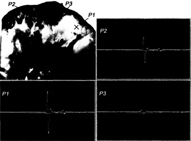 Table 2: Amplitude of waveform (A) 