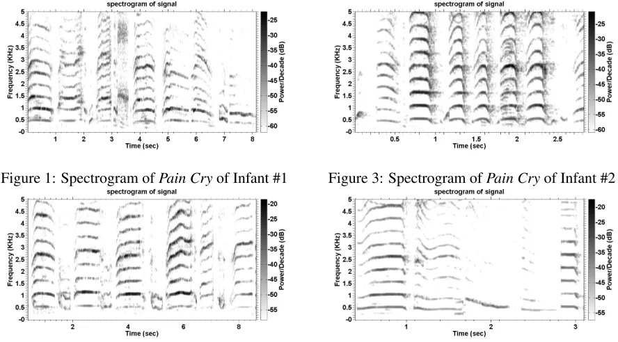 Figure 1: Spectrogram of Pain Cry of Infant #1