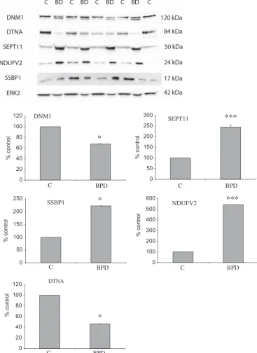 Figure 2.Validation of differentially expressed proteins. Protein expression changes were determined in the 18 subpooled cases of the Stanleyrecognize Dynamin (DNM1) at 120 kDa, Dystrobrevin (DTNA) at 84 kDa, Septin 11 (SEPT11) at 50 kDa, (NDUFV2) at 24 kD