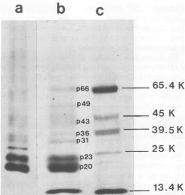 FIG. 2.particles Comparison of the polypeptides ofHBsAg from PLC/PRF/5 cells and from human