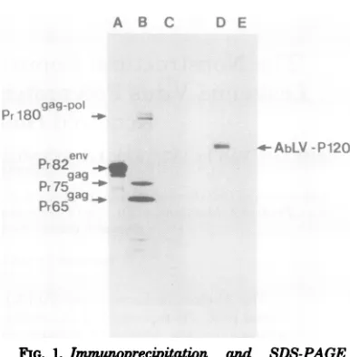 FIG. 1.proteinsMuLV(AformedgradientNIH/3T3analysiscontainingRauscherinCi/mmol,unlabeledImmuneSepharoseexperimentslysedtionof(B),cataway,andalizedTriton [35SJmethionine Laemmli ImmunoprecipitationandSDS-PAGE of [35SJmethionine-labeled viral proteins