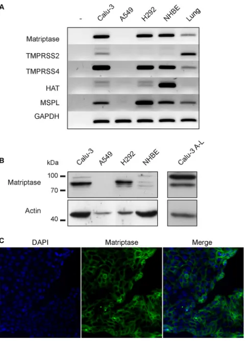 FIG 1 Matriptase is expressed in the normal human lung and humanbronchial epithelial cells