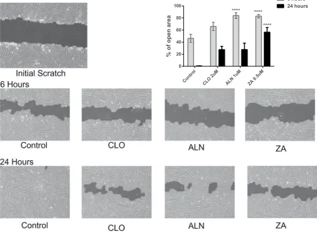 Figure 5. Endothelial lineage of the VEGF treated pMSCs was confirmed by Ac-LDL uptake after 10 days