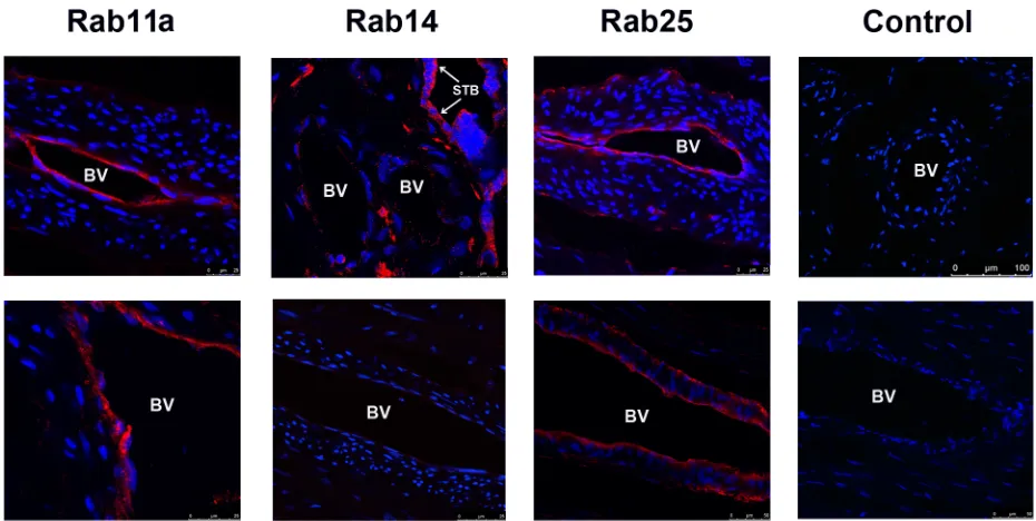 Fig 7. Expression of Rab11 subfamily in human placental blood vessels. Immunofluorescence microscopy analysis of Rab11,Rab14, and Rab25 expression in the fetal blood vessels within human placental samples