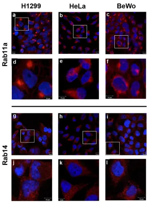 Fig 2. Comparative localization patterns of Rab11a and Rab14 in human cell lines. Rab11a and Rab14immunofluorescence microscopy
