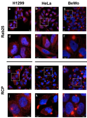 Fig 3. Comparative localization patterns of Rab25 and RCP in human cell lines. Rab25 and RCPlocalization was examined in H1299 (a,d,g,j), HeLa (b,e,h,k) and BeWo (c,f,i,l) cell lines by confocalimmunofluorescence microscopy