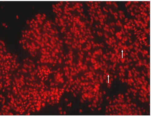 Figure 4.  Propidium Iodide labeled nuclei viewed through a PI filter. 