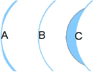Figure 4.6 (A) minus lens with peripheral shoulder, (B) back surface parallel to front surface 