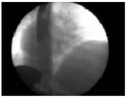 Figure 6:  Medical X-ray image              