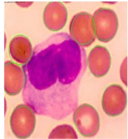 Figure 14: Flow chart of the red blood cells counting process.  