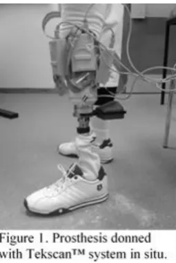 Figure-Table II highlights key information regarding used prostheses. Bench and dynamic alignment were performed until participant comfortable and Prosthetist satisfied