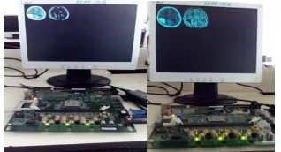 Figure 7 shows the Prewitt and Sobel edge detection techniques implemented on FPGA and its result displayed on the VGA monitor