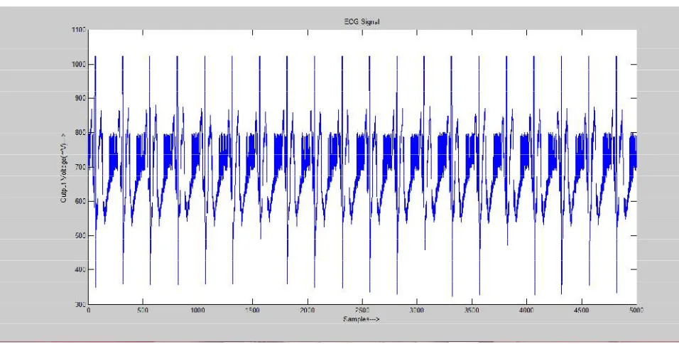 Figure 5: Graphical Representation of Acquired ECG  