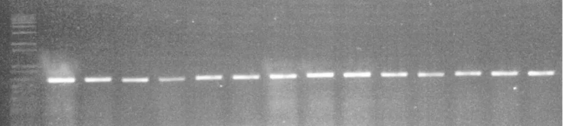 Figure  2.  Capture  of  the  photograph  of the 1% agarose gel, showing  the positive bands for virulence  gene tested by PCR assay