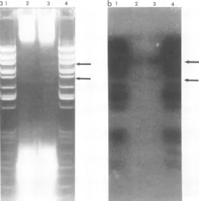 FIG. 6.phageRoyalisolatedwith(b) Autoradiograph Electrophoretic analysis of intracellular DNA from FST complexes