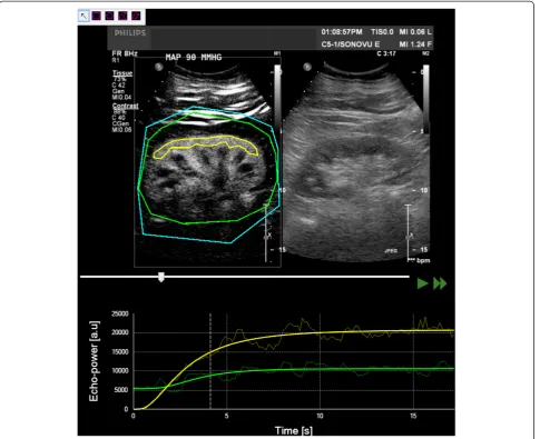 Figure 1 Sequence analysis with Vuebox®. A region of interest was drawn (yellow line) in the largest possible area of renal cortex close to theultrasound probe